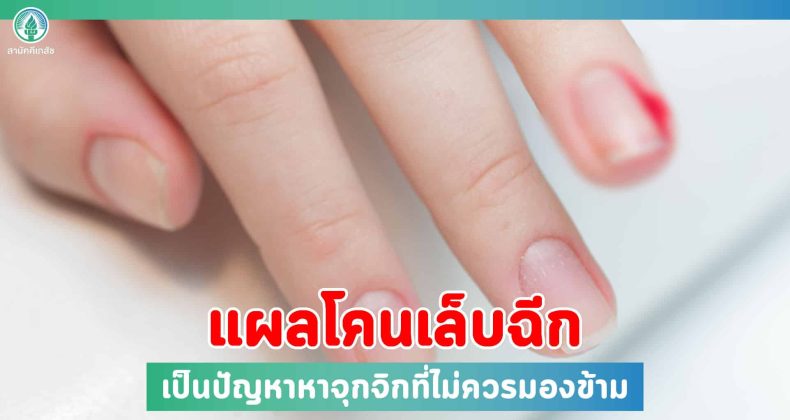 2022-06-30 Seo-01