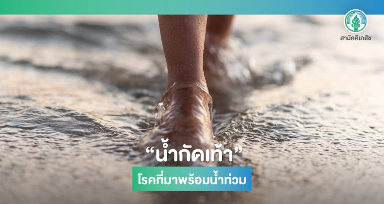 น้ำกัดเท้า-01