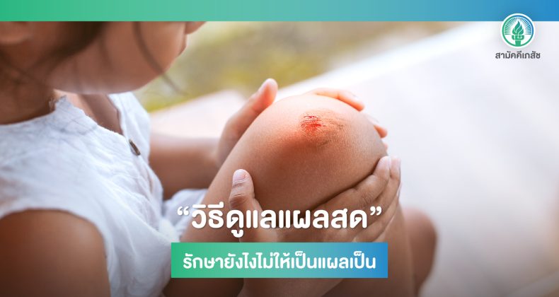 วิธีดูแลแผลสด-01